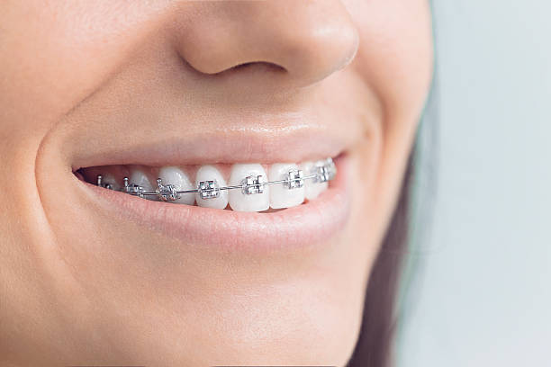 Best Emergency Dental Care  in Moreauville, LA